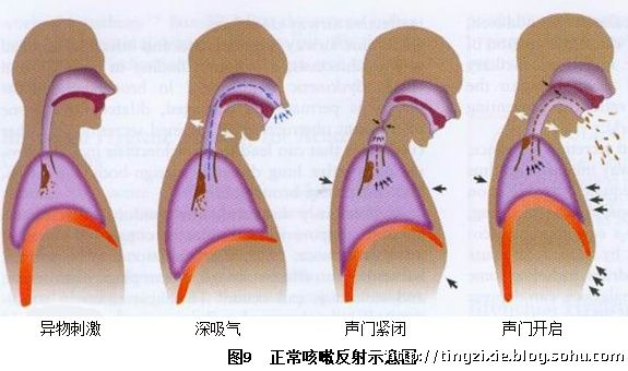 喷门迟缓症最新疗法